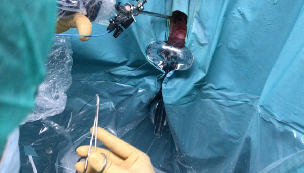 El uso del videoanálisis en una intervención quirúrgica