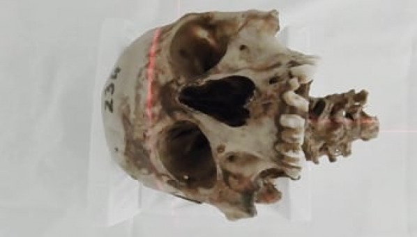 La Cátedra colabora en el estudio de cráneos guanches del MUNA 
